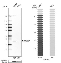TTC39A Antibody, Novus Biologicals:Antibodies:Primary Antibodies